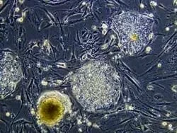 Стволовые клетки вновь грозят раком
